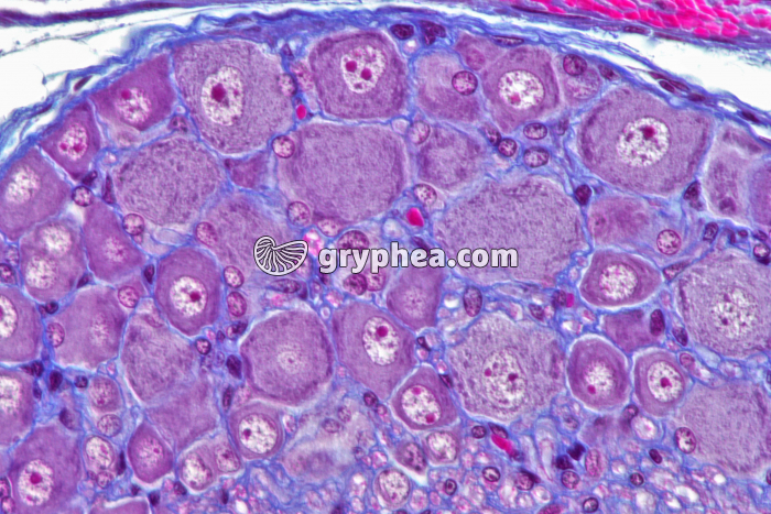 Ganglion rachidien CT x200 - gryphea.com